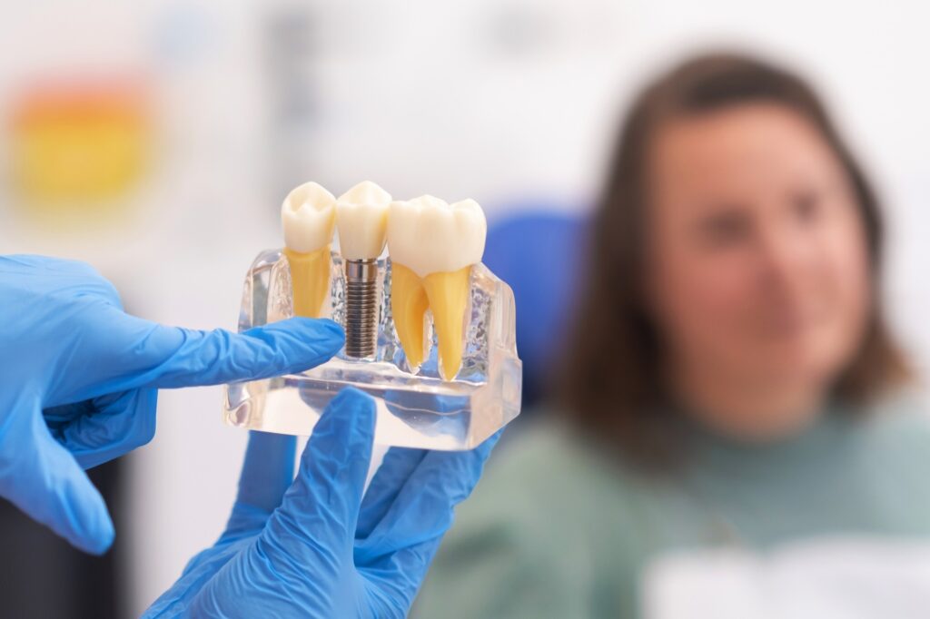 Dental Implants, Invisalign, and Composite Bonding Explained