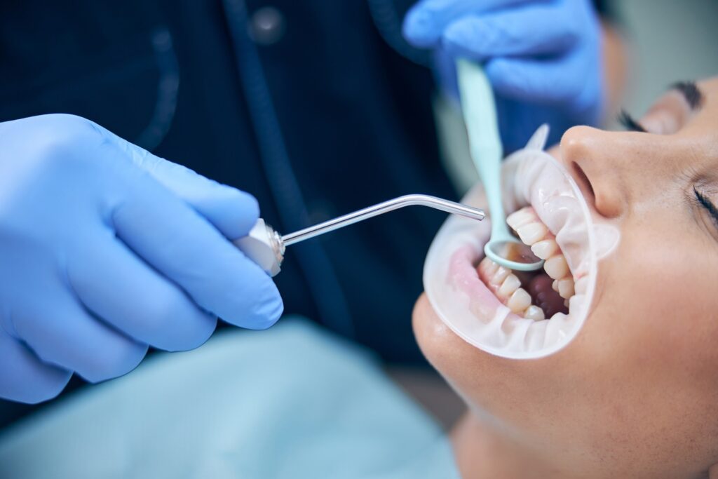 Composite Bonding: A Minimally Invasive Solution