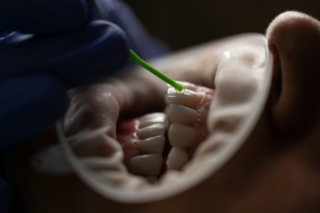tooth-coloured resin