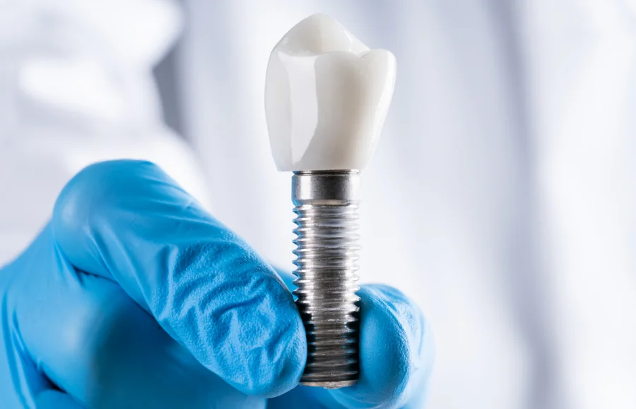 Single-Dental-Implants-Hero