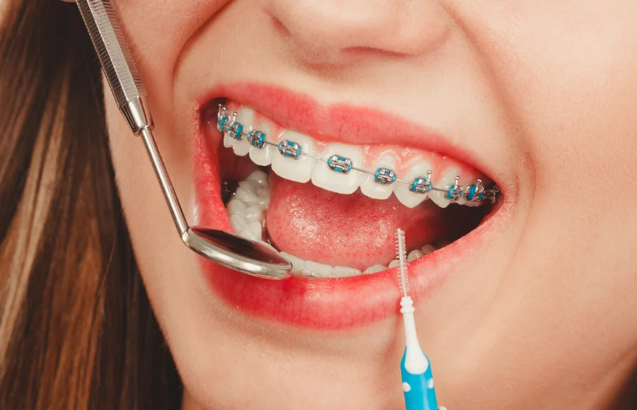fixed-braces-inline-2