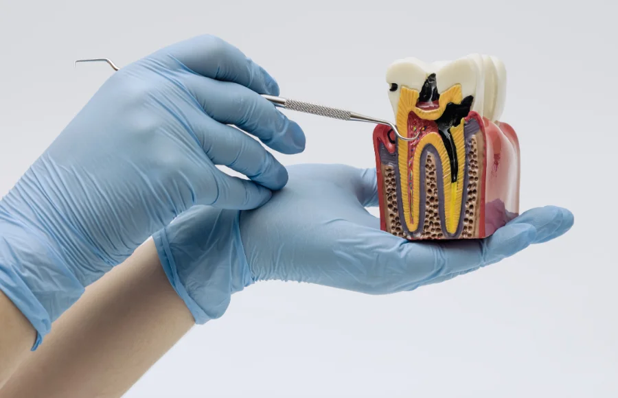 root-canal-treatment-hero