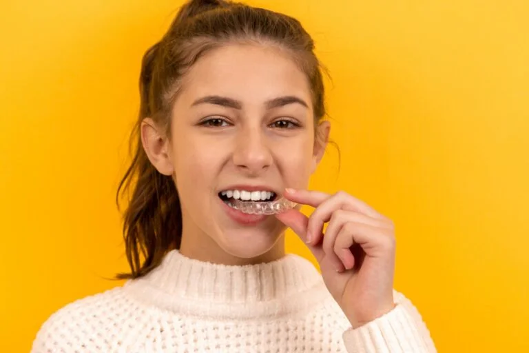 How Invisalign Can Correct Overbite and Underbite Issues