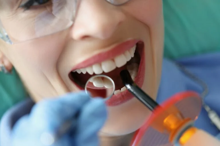 How to Fix Chipped Teeth with Composite Bonding in Merley