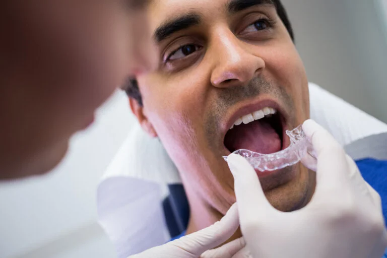 How to Know if Invisalign in Broadstone Is Right for You