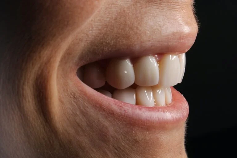 Innovative Solutions in Cosmetic Dentistry for a Perfect Smile