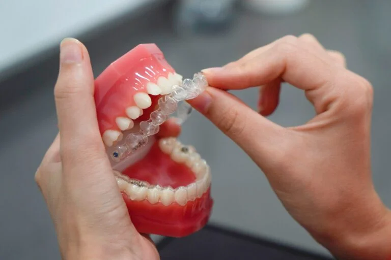 Invisalign The Comfortable Way to Straighten Teeth