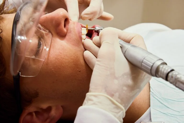 The Best Practices to Maintain Your Invisalign Aligners