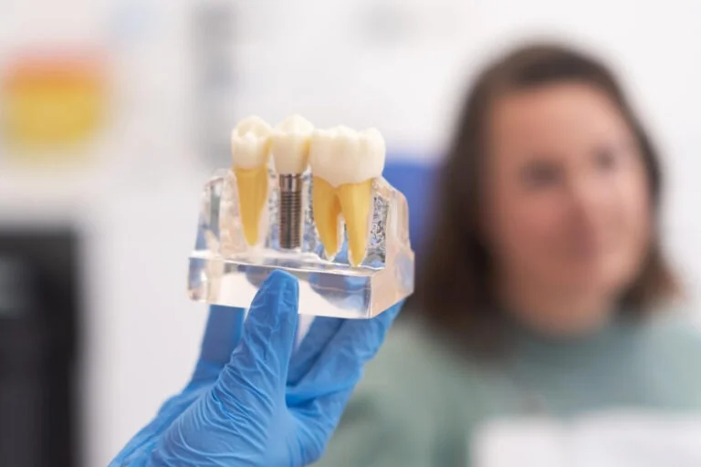 The Long-Term Benefits of Getting Dental Implants