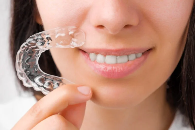 What Makes Invisalign in Shaftesbury So Popular