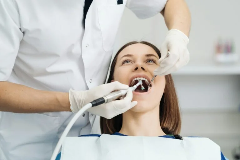 What to Do If Your Composite Bonding Chips or Breaks