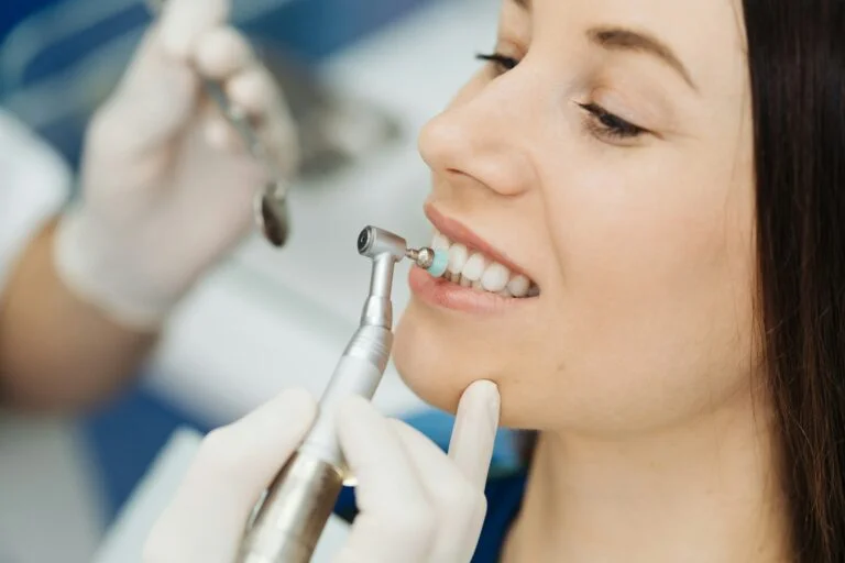 When to Consider Composite Bonding for Cosmetic Dental Work